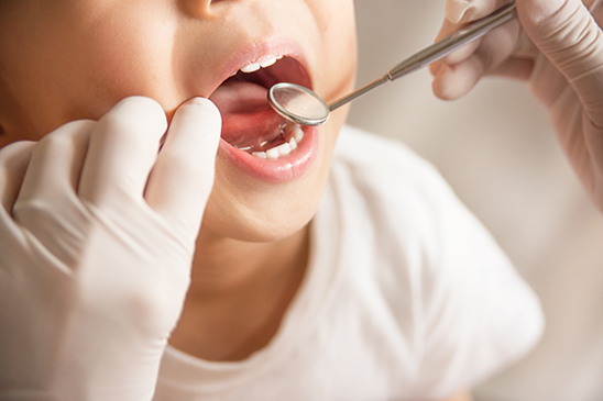 お子様がなりやすい「歯」「お口の中」の病気